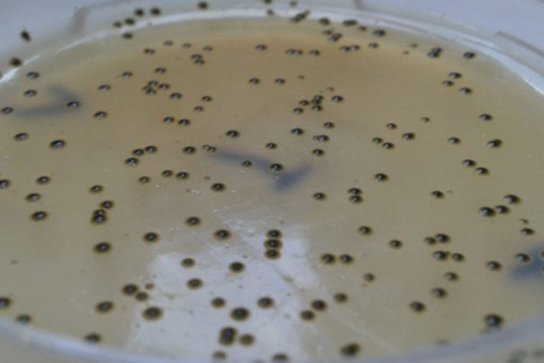 Bactéria “Staphylococcus aureus” consegue sobreviver na água potável